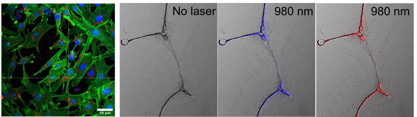 Confocal microscopy image of cells alongside upconversion luminescence imaging under no laser, and under 980 nm laser excitation shown in blue and red channels